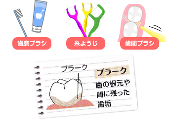 メンテナンス｜プラークコントロール2