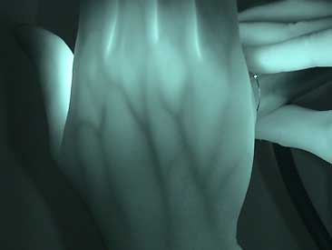 エステ・サプリ｜赤色LEDは皮膚の4～5cm下まで透過するので手に当ててみると皮膚を透過して血管まで見えます。