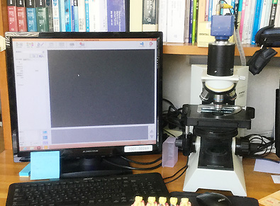 各種検査｜位相差顕微鏡
口の中のプラーク（歯垢）を採取して顕微鏡で拡大したものをモニターで見ることができます