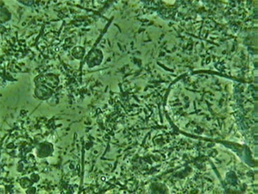 各種検査｜口腔内細菌検査の治療前