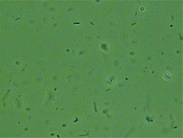 各種検査｜各種検査｜口腔内細菌検査の治療後