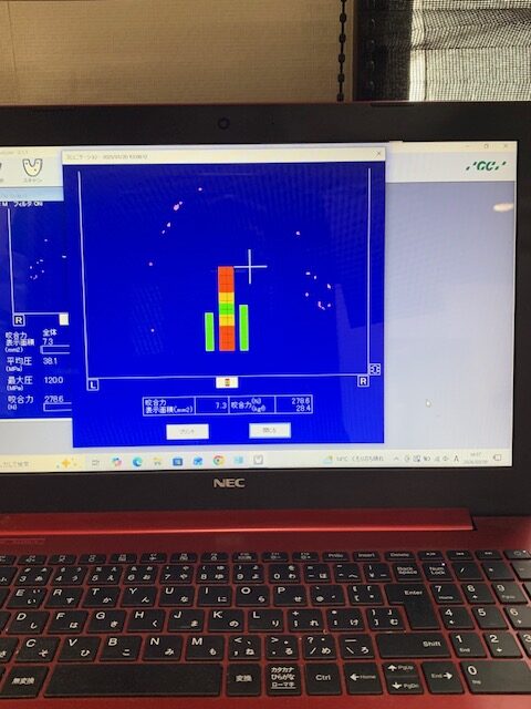 各種検査｜咬合圧測定器