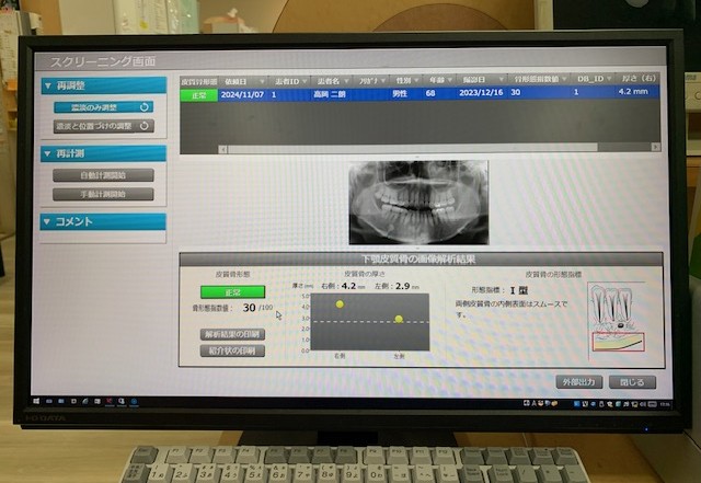 各種検査｜骨密度検査
